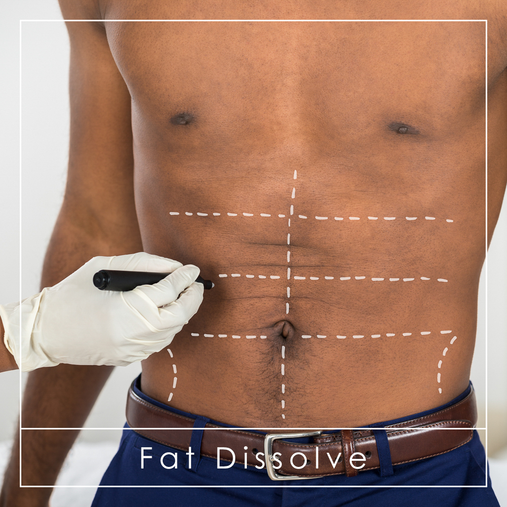 Fat Dissolve at A Grade Aesthetics