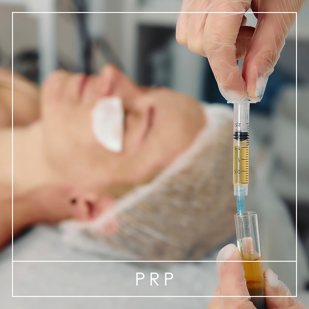 PRP at A Grade Aesthetics